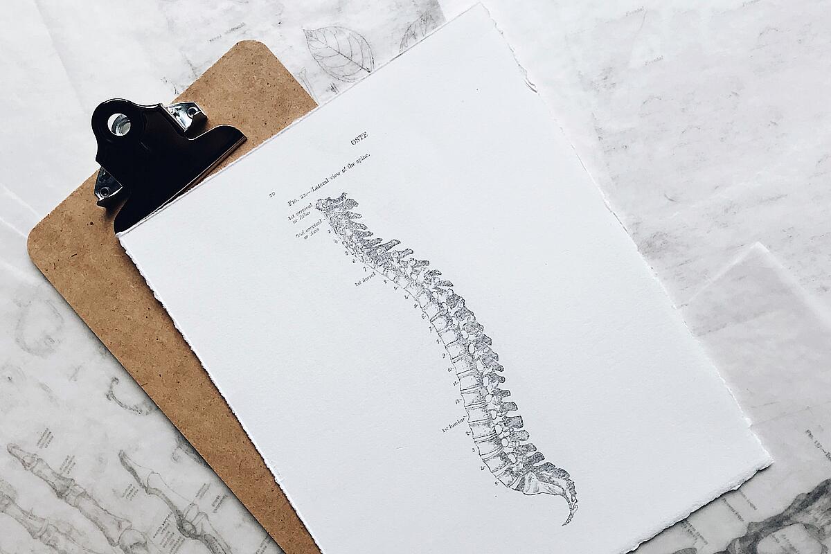 Rückenschmerzen - Zeichnung einer Wirbelsäule