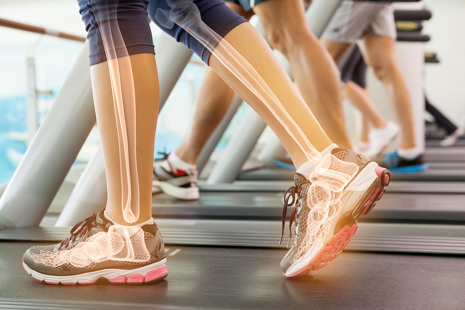 Beine von Läuferinnen auf einem Laufbank - Knochendichtemessung